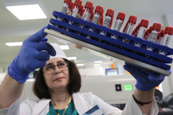 Фотография к новости: Стало известно о 28 новых случаях заражения COVID-19 в Казахстане