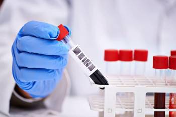 Фотография к новости: 17 новых случаев COVID-19 зарегистрировано на территории Казахстана