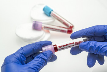 Фотография к новости: Медики рассказали подробности о последних 26 заболевших КВИ в Нур-Султане