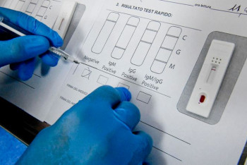 Фотография к новости: Как в Казахстане сдают экспресс-тесты на коронавирус