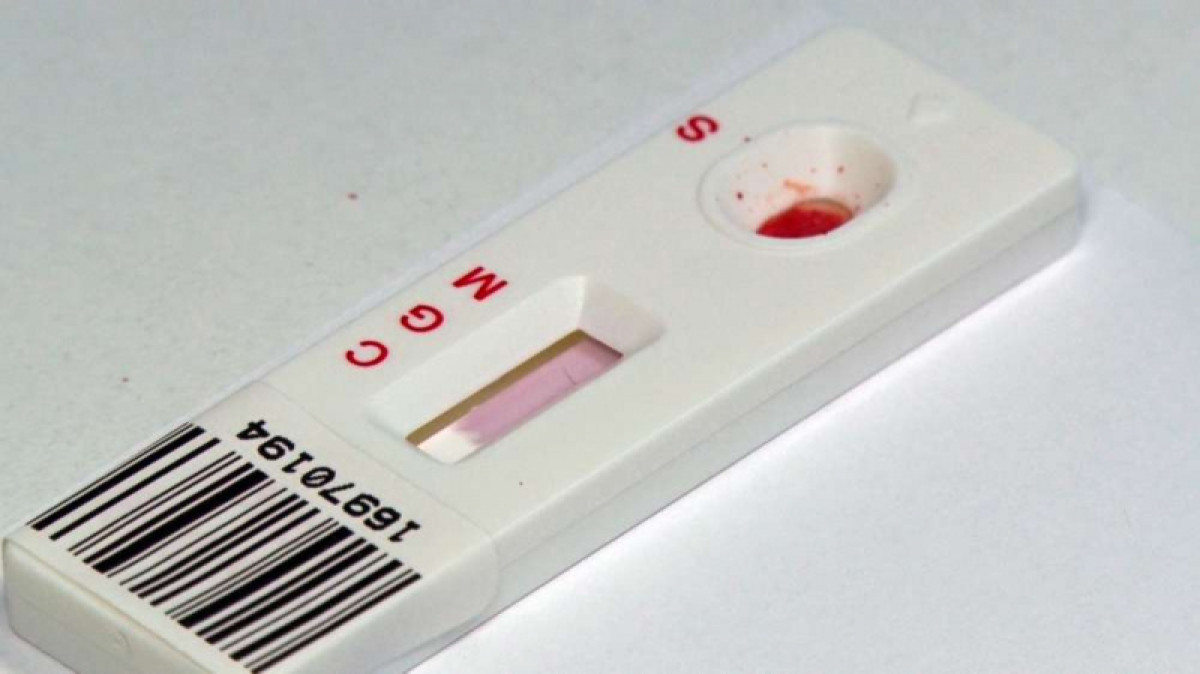 Фото Baigenews.kz