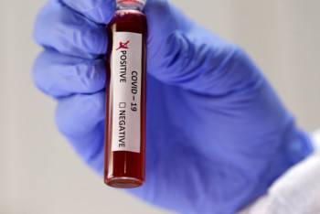 Фотография к новости: Еще 15 случаев заражения КВИ зафиксировано в Казахстане