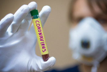 Фотография к новости: Стали известны подробности о 16 новых случаях заражения КВИ