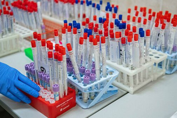 Фотография к новости: 67 курсантов КНБ и два пилота заразились коронавирусом в Алматы