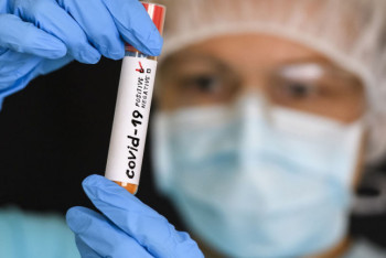 Фотография к новости: Еще 42 казахстанца заболели коронавирусом