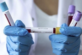 Фотография к новости: Еще 37 случаев коронавируса выявили в Казахстане