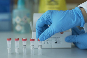 Фотография к новости: Еще 33 зараженных COVID-19 выявили в Казахстане