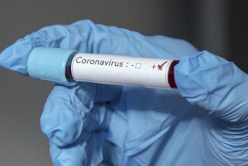 Фотография к новости: Еще 27 казахстанцев заболели коронавирусом