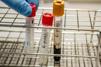 Фотография к новости: Еще 21 казахстанец вылечился от КВИ