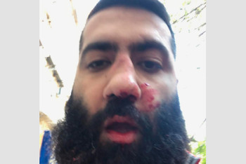 Фотография к новости: Вице-спикер армянского парламента подрался с противниками премьер-министра страны