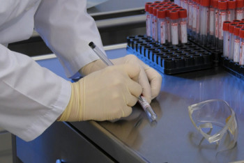 Фотография к новости: 102 новых случая COVID-19 выявили в Казахстане