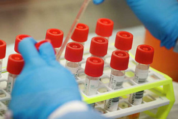 Фотография к новости: 74 новых случая коронавируса выявлены в Казахстане