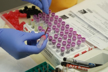 Фотография к новости: Выявлено 114 новых случаев КВИ, из них больше половины – в Алматы