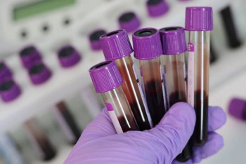 Фотография к новости: Число подтвержденных случаев коронавируса достигло 3800 в Казахстане