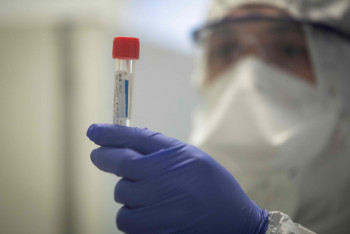 Фотография к новости: Еще семь новых случаев коронавируса выявили в Казахстане