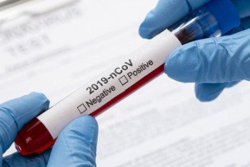 Фотография к новости: Снижена стоимость тестов на коронавирус в Нур-Султане