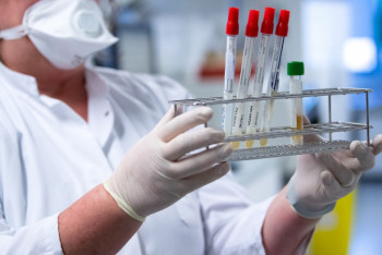 Фотография к новости: Число случаев коронавируса достигло 4530 в Казахстане