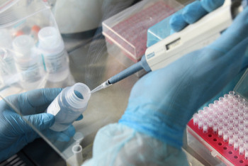 Фотография к новости: Еще 48 случаев заболевания коронавирусом выявили в Казахстане