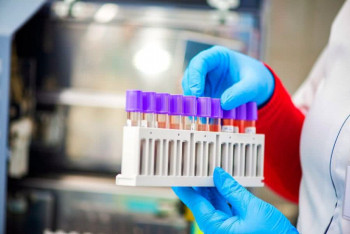 Фотография к новости: 88 новых случаев коронавируса выявили в Казахстане