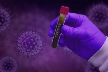 Фотография к новости: Ученые предупреждают об опасности бесплодия у женщин после COVID-19