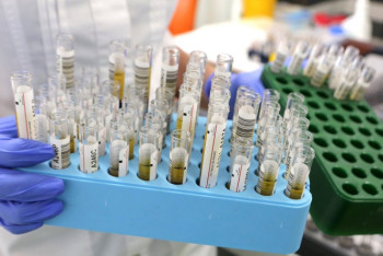 Фотография к новости: За один день скрининг показал коронавирус почти у 80 человек в Шымкенте