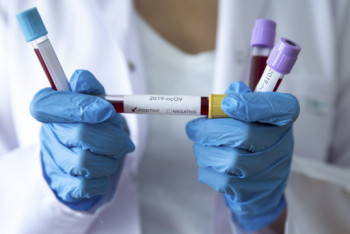 Фотография к новости: 283 новых случаев заражения КВИ зарегистрировано в Казахстане