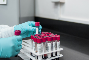 Повторных случаев заражения КВИ не зарегистрировано в Казахстане