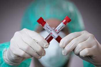 Фотография к новости: ВОЗ сообщила о рекордном числе заражений коронавирусом за сутки