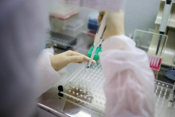 В ВОЗ прокомментировали ведение раздельной статистики зараженных COVID-19 в Казахстане