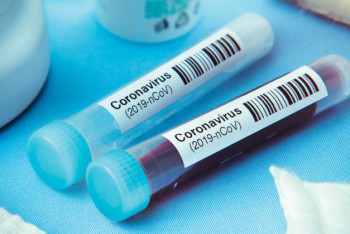 Фотография к новости: Казахстан дополнительно закупит 1,2 миллиона ПЦР-тестов на COVID-19