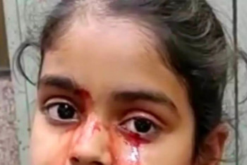 Фотография к новости: 11-летняя девочка ежедневно плачет кровью