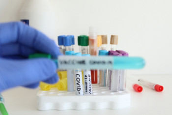 Фотография к новости: Информацию о заражениях КВИ от реагентов назвали фейком в Алматы