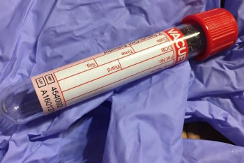 Фотография к новости: Врач рассказал о самочувствии испытателей вакцины от коронавируса