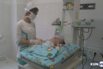 Фотография к новости: Двухголовые сиамские близнецы родились в Самарканде