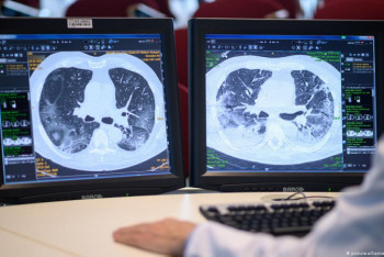 Фотография к новости: О влиянии препаратов при лечении КВИ на почки и сердце рассказали врачи