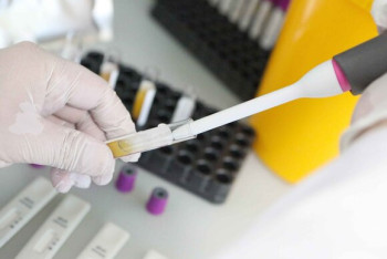 Фотография к новости: Разные результаты анализов на CОVID-19 получила супружеская пара в двух лабораториях Актау