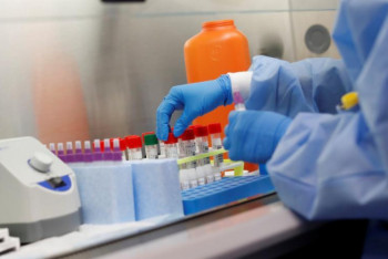 Фотография к новости: Изобретен прибор для мгновенного обнаружения COVID-19 в организме