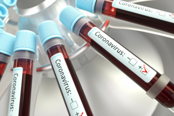 Фотография к новости: Почти полторы тысячи казахстанцев заразились коронавирусом за сутки