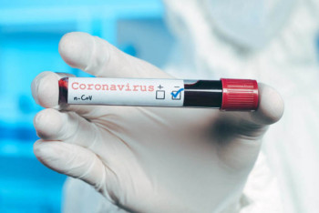 Фотография к новости: Число выздоровевших от COVID-19 казахстанцев достигло 57 815