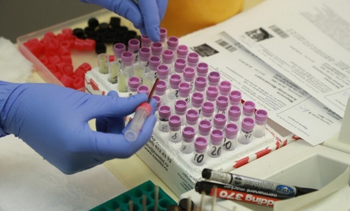 За сутки у 1414 человек выявили коронавирус в Казахстане