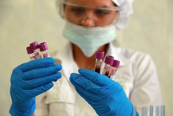 Фотография к новости: 90-тысячную отметку превысило число случаев КВИ в Казахстане