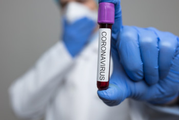 Фотография к новости: 980 человек заболели КВИ за сутки в Казахстане