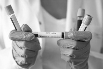 Фотография к новости: Еще 31 человек скончался от КВИ и пневмонии в Казахстане