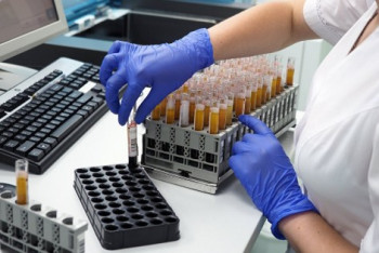 Фотография к новости: 439 новых случаев КВИ зарегистрировали за сутки в Казахстане