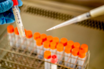 Фотография к новости: 409 новых случаев COVID-19 зарегистрировали за сутки в Казахстане