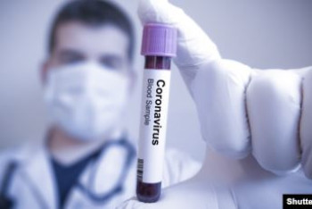 Фотография к новости: Еще 540 человек выздоровели от COVID-19 в РК