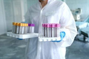 Фотография к новости: 111 новых ковид-больных зарегистрировали за сутки в Казахстане