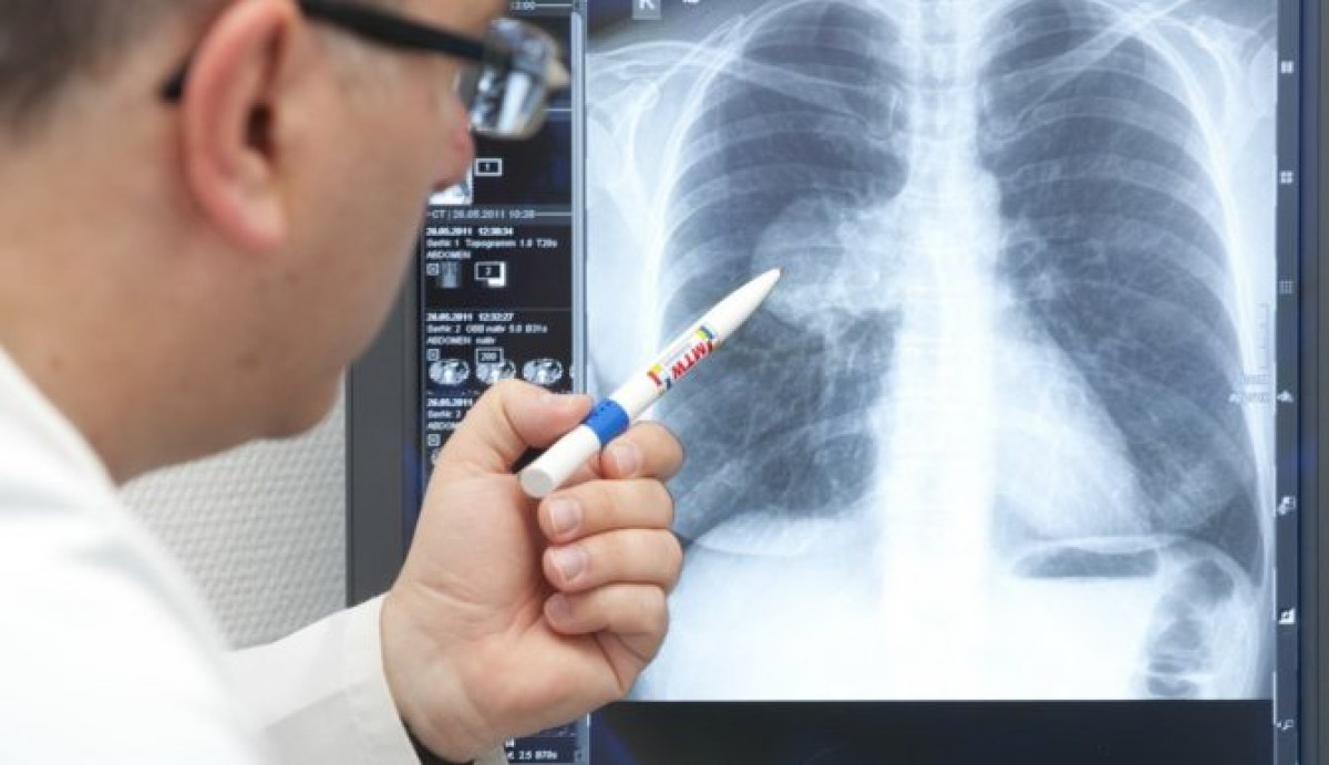 Восемь человек скончались от КВИ и пневмонии в Казахстане за сутки