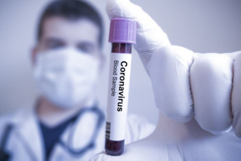 Фотография к новости: Чаще всего антитела к коронавирусу у кызылординцев и актюбинцев – исследование