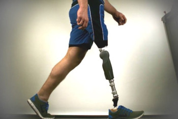 Фотография к новости: Полицейские и КУИС помогли осужденному получить протез ноги в ЗКО